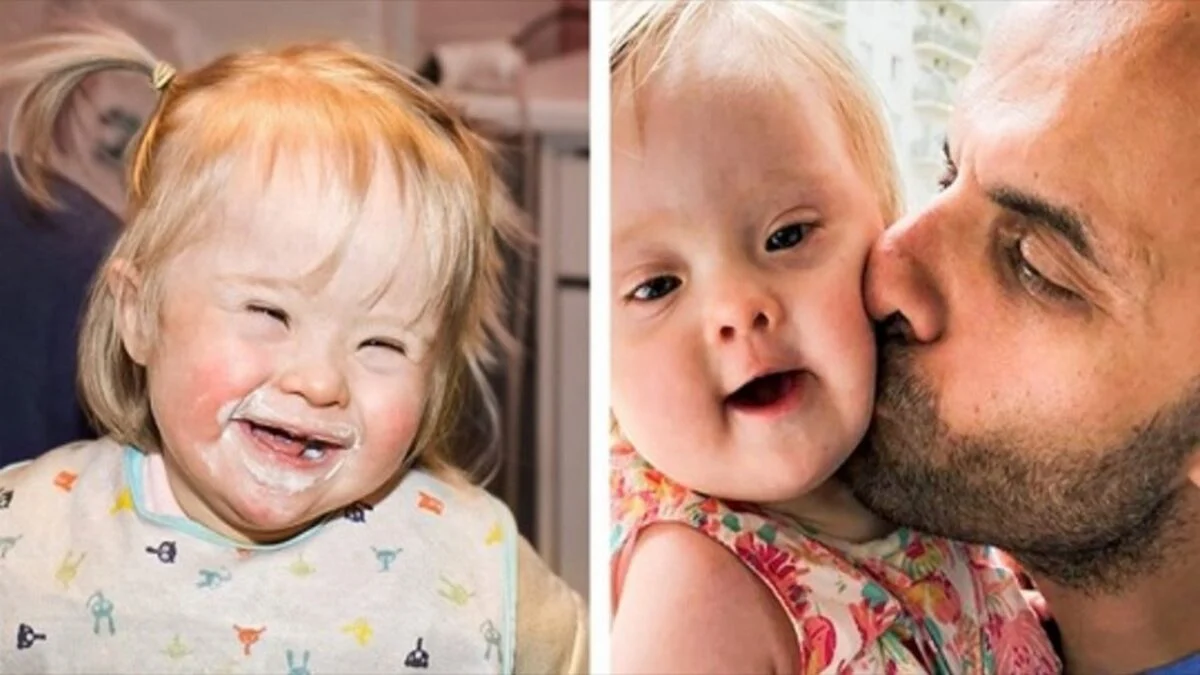 Il adopte une fillette de 13 jours  atteinte du syndrome de down  qui a été rejetée 20 fois