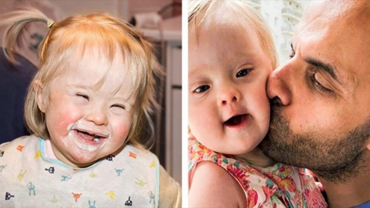 Il adopte une fillette de 13 jours atteinte du syndrome de down qui a été rejetée 20 fois 7 Il adopte une fillette de 13 jours atteinte du syndrome de down qui a été rejetée 20 fois Il adopte une fillette de 13 jours  atteinte du syndrome de down  qui a été rejetée 20 fois