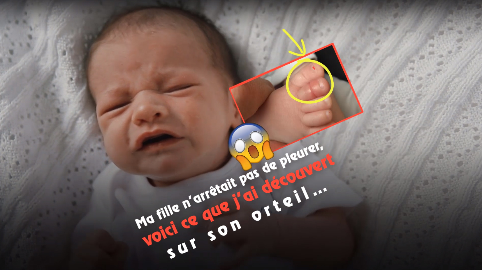 Ma fille n’arrêtait pas de pleurer, voici ce que j’ai découvert sur son orteil… 3 Ma fille n’arrêtait pas de pleurer, voici ce que j’ai découvert sur son orteil… Ma fille n’arrêtait pas de pleurer, voici ce que j’ai découvert sur son orteil…