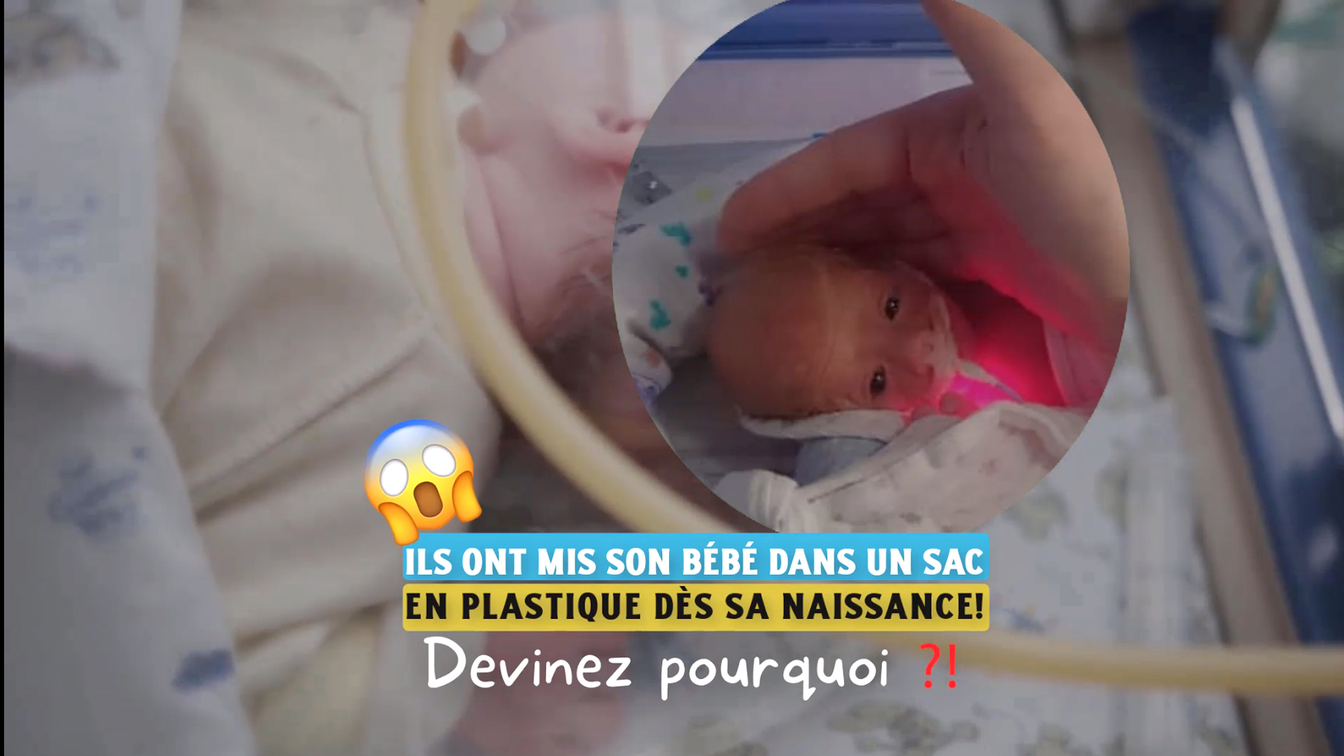 Ils ont mis son bébé dans un sac en plastique dès sa naissance, devinez pourquoi?