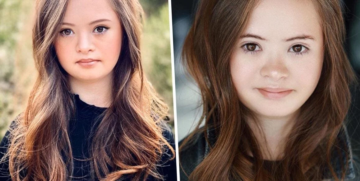 girl down syndrome becomes successful model e1610960410544 girl down syndrome becomes successful model e1610960410544