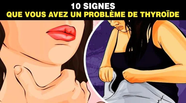 10 signes que vous avez un probleme de thyroide