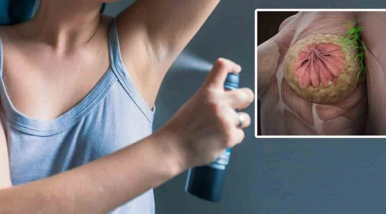 40 des cas de cancer du sein pourraient etre evites si les femmes faisaient ces 9 choses 1