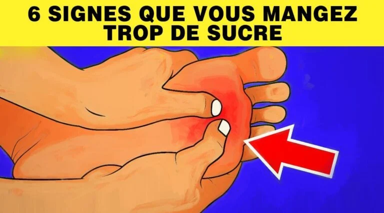6 signes que vous mangez trop de sucre