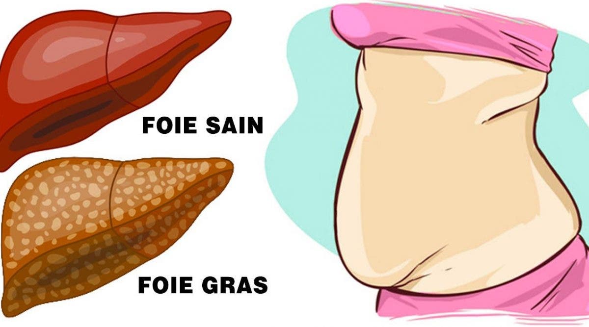 8 signes dalerte indiquant que votre foie est plein de toxines et vous fait grossir2