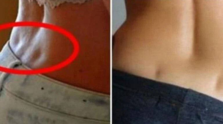 Voici pourquoi certaines personnes ont des fossettes lombaires au bas du dos 1 1 1200x667 1