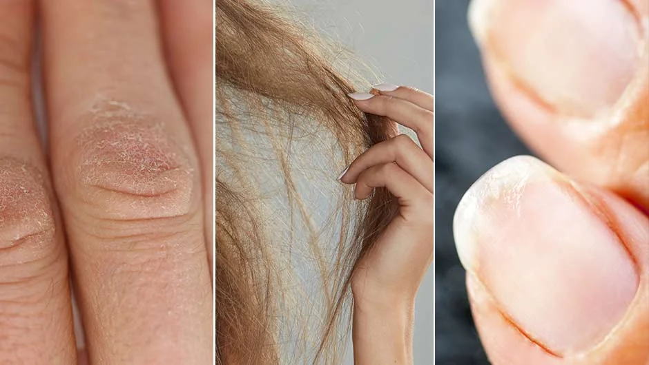 dry hair skin nails dry hair skin nails
