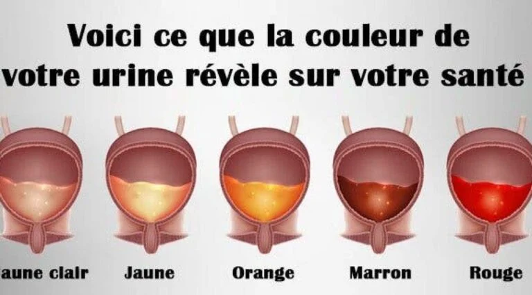 verifiez durgence la couleur de votre urine 1 1200x667 1
