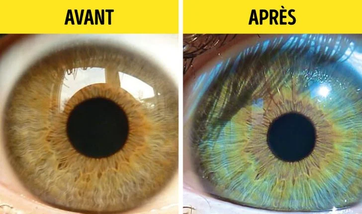5 raisons qui peuvent faire changer la couleur de vos yeux2 5 raisons qui peuvent faire changer la couleur de vos yeux2