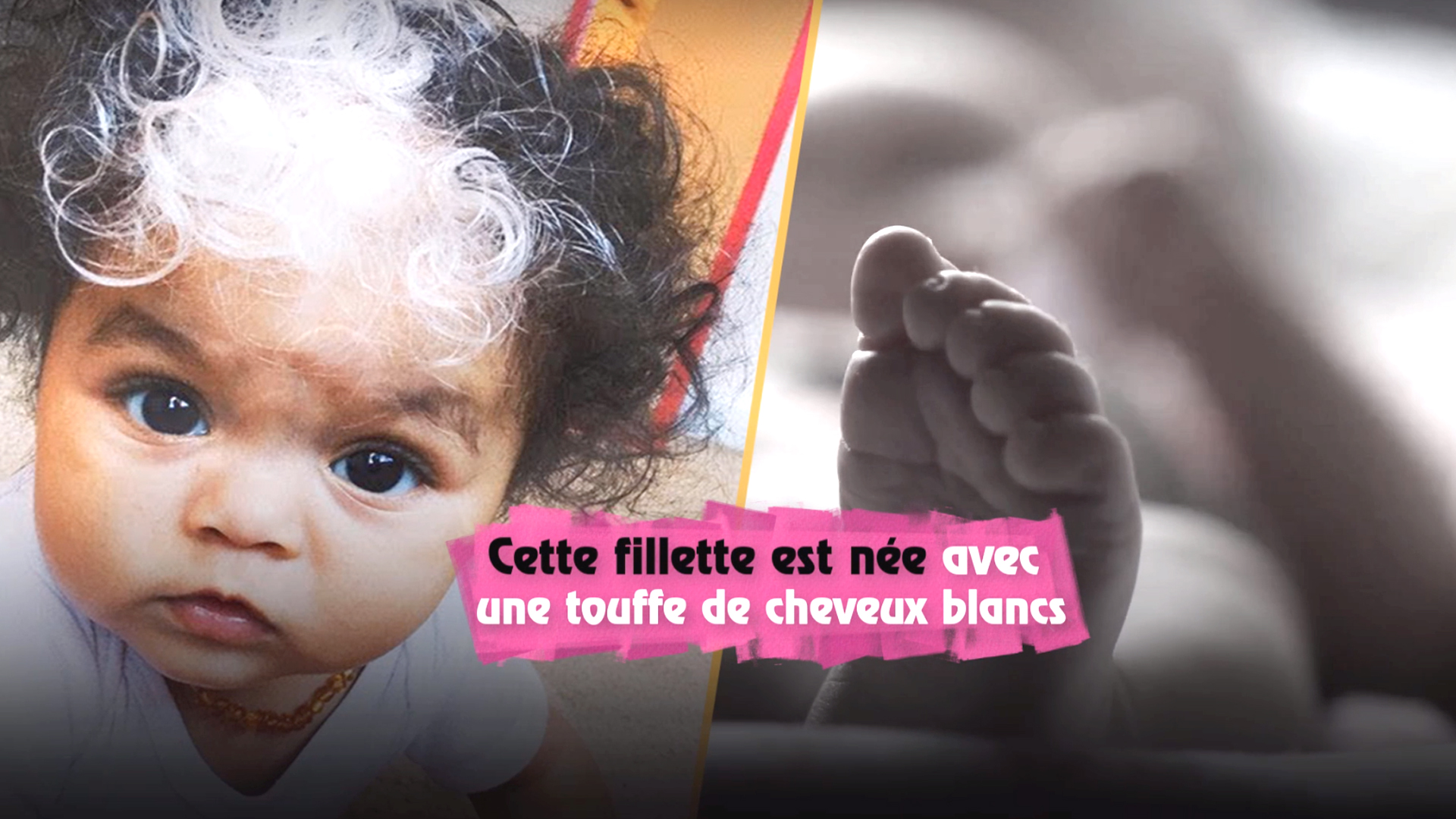 Cette fillette est née avec une touffe de cheveux blancs, tout comme sa mère..