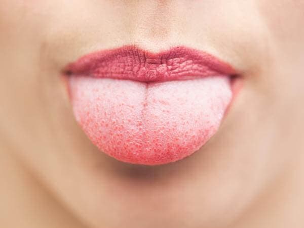 6 choses que votre langue peut reveler sur votre etat sante 1