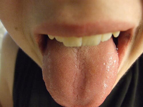 6 choses que votre langue peut reveler sur votre etat sante 2