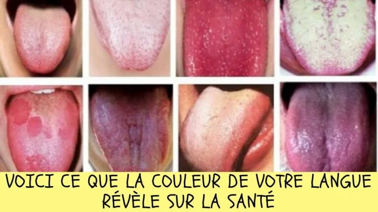 6 choses que votre langue peut reveler sur votre etat sante