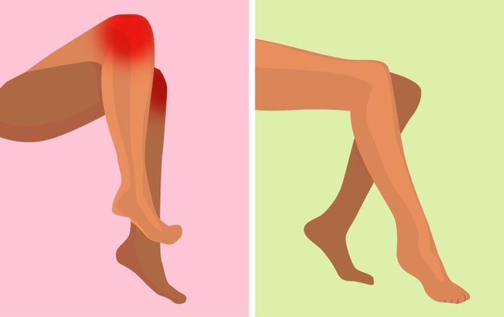 Comment votre corps peut il etre affecte si vous vous asseyez souvent les jambes croisees 2 e1620311025819