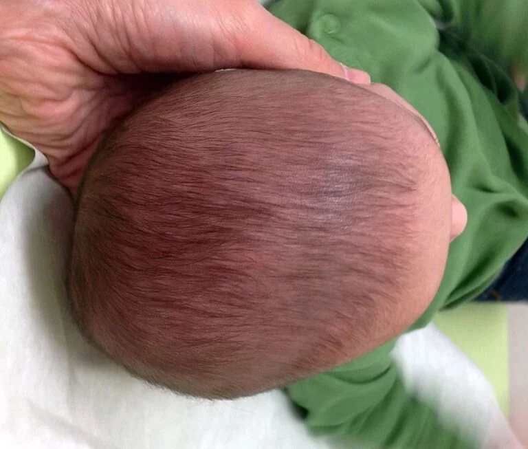 sante enfant 1