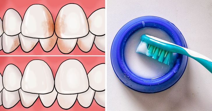 8 facons deliminer les taches de tartre de vos dents