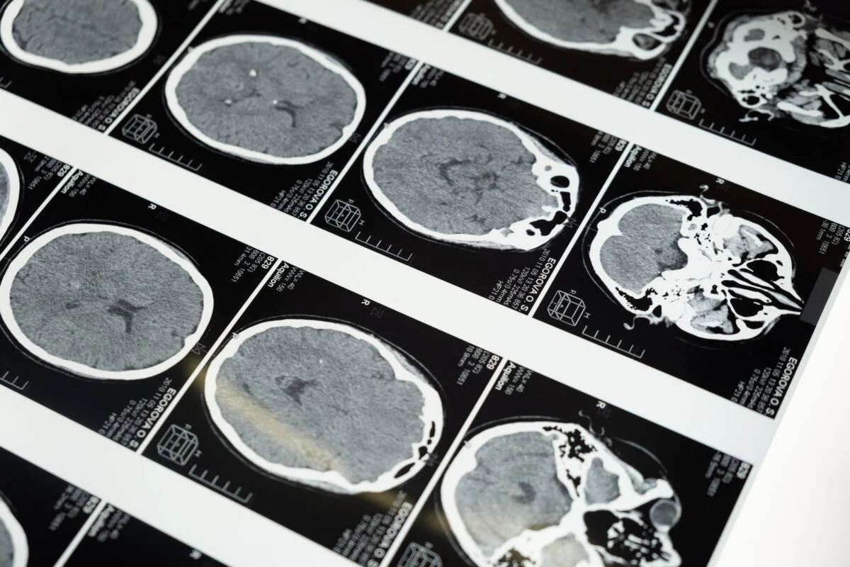Une etude terrifiante revele quapres la mort notre cerveau sait que lon est decede 2 Une etude terrifiante revele quapres la mort notre cerveau sait que lon est decede 2