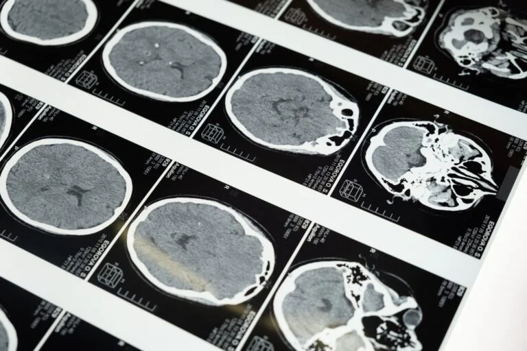 Une etude terrifiante revele quapres la mort notre cerveau sait que lon est decede 2