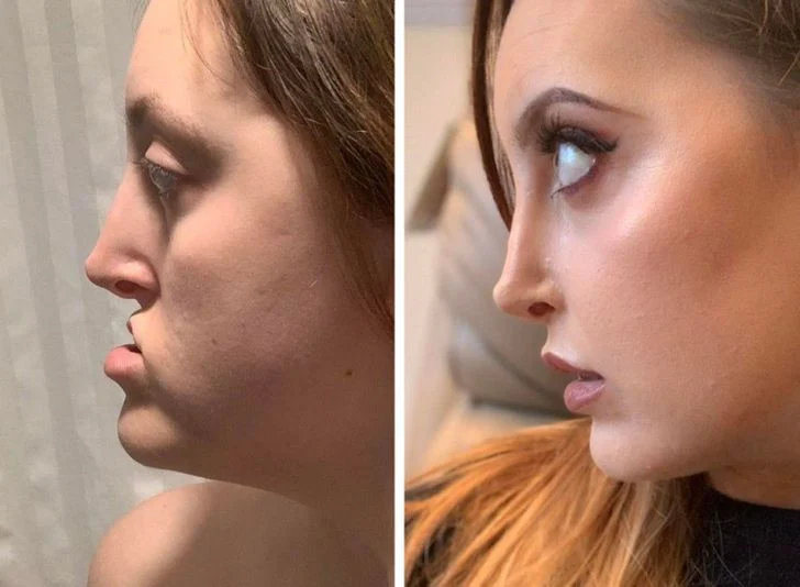 12 personnes qui ont eu recours a la chirurgie plastique et qui assument leur nouveau look 2 12 personnes qui ont eu recours a la chirurgie plastique et qui assument leur nouveau look 2