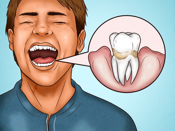 4 signes qui montrent que vous vous brossez les dents trop fort 1 1