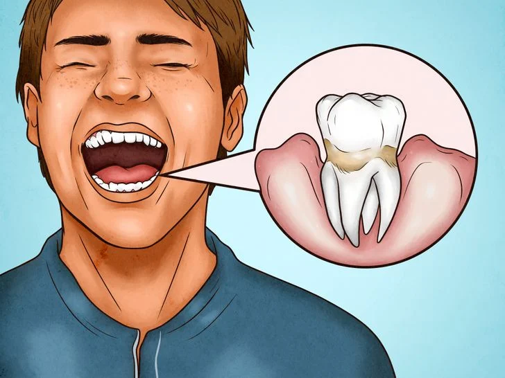 4 signes qui montrent que vous vous brossez les dents trop fort 1 1 4 signes qui montrent que vous vous brossez les dents trop fort 1 1