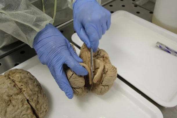 Un neurobiologiste explique ce qui se passe 30 secondes avant notre mort 1 Un neurobiologiste explique ce qui se passe 30 secondes avant notre mort 1