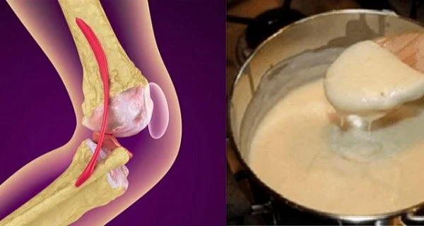 La gélatine peut renforcer les cartilages défectueux