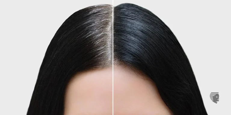 cheveux blancs remède