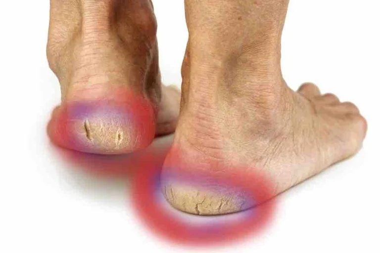 pieds secs