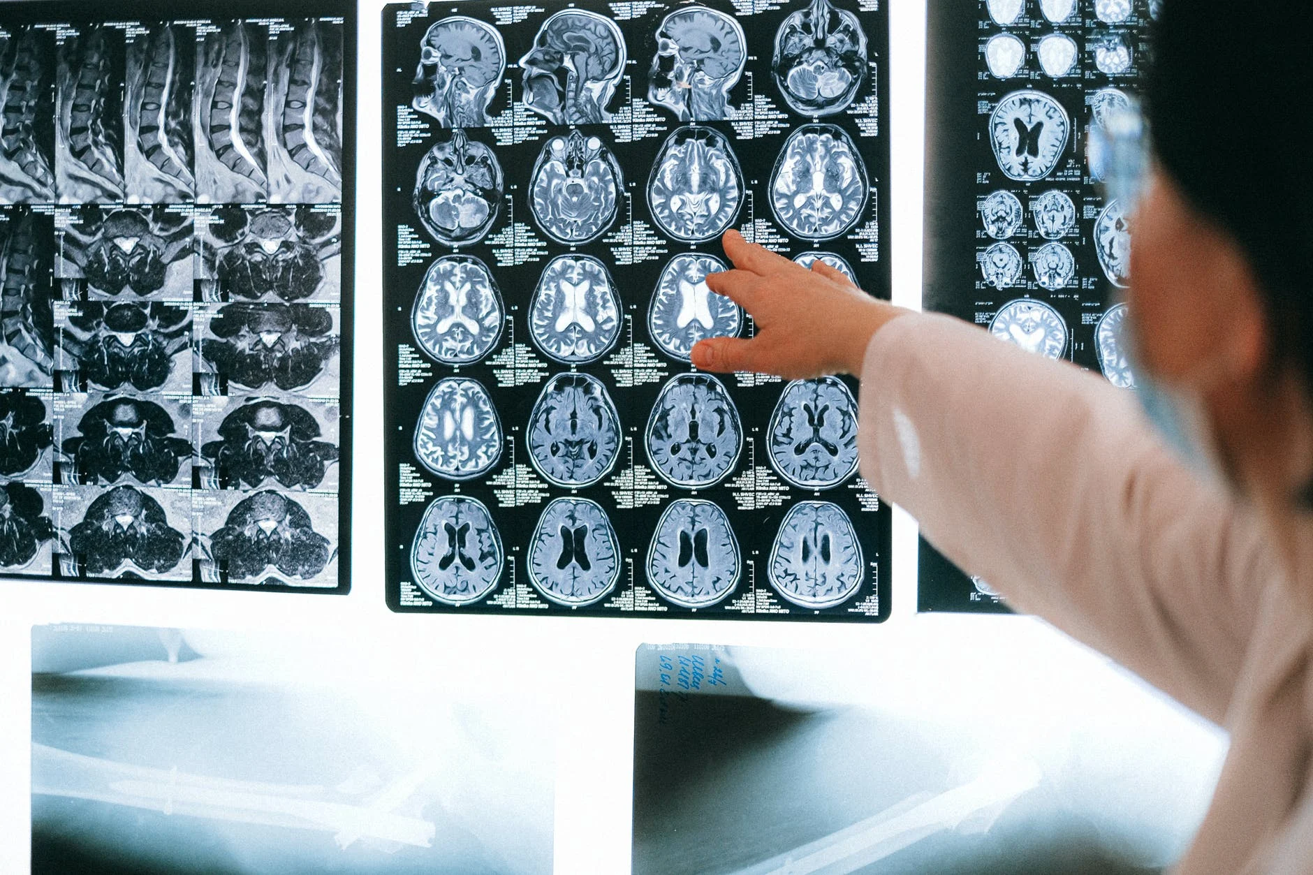 Le stress et votre cerveau