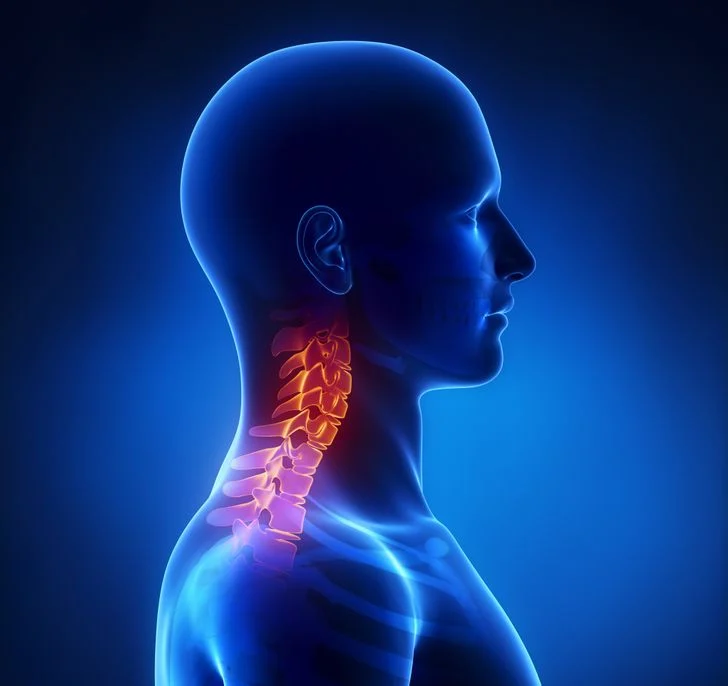 Douleurs cervicales