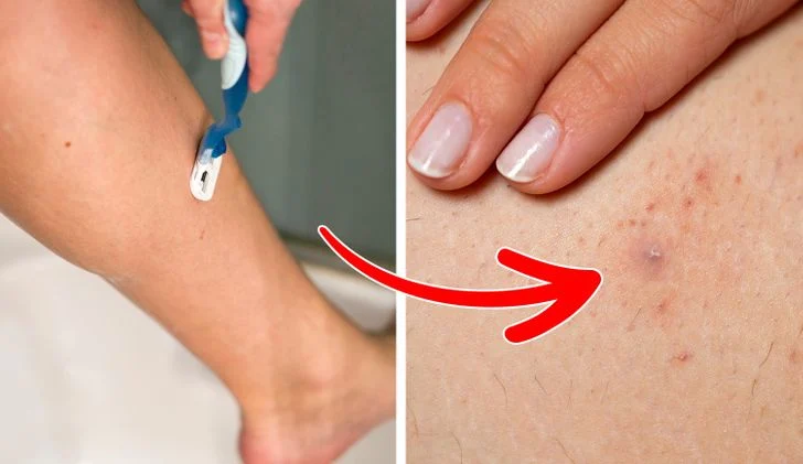 Rasage ou épilation à la cire 3 rasage pieds cire boutons