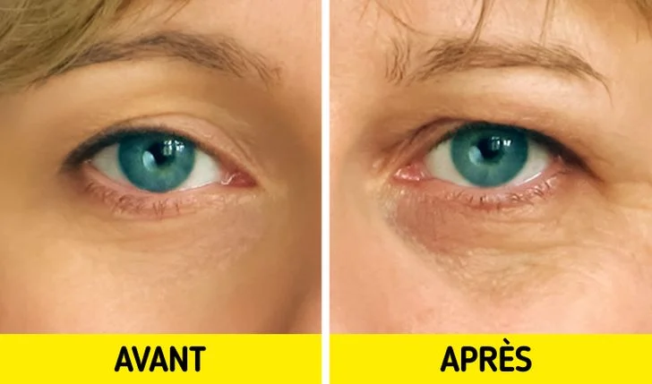 exercices feront disparaître vos ridules