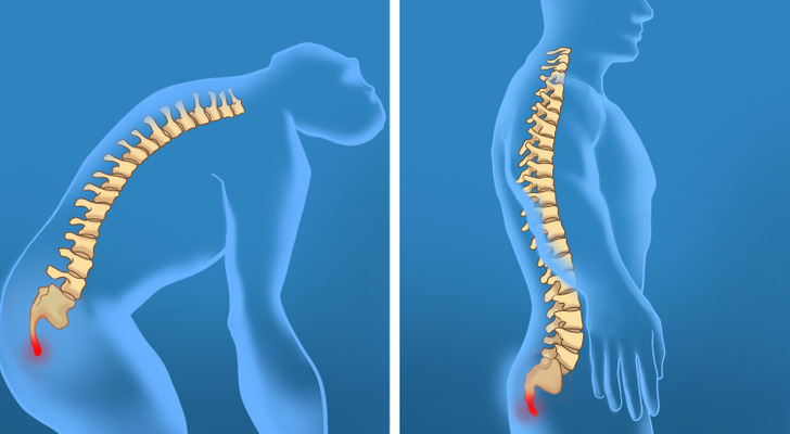 Le coccyx