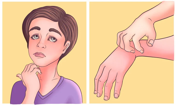 réactions allergiques