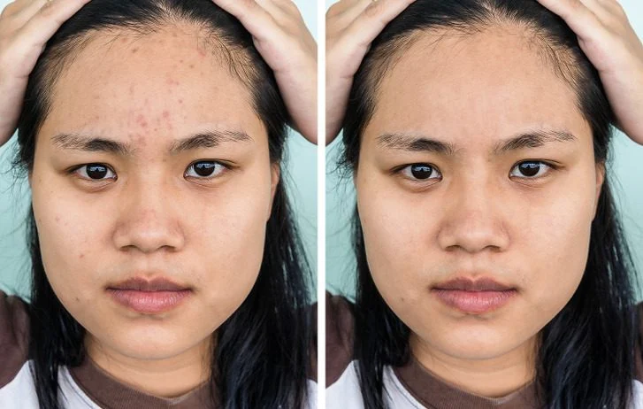 4 raisons pour lesquelles vous ne devriez plus dormir avec des couvertures Votre peau est mieux protégée