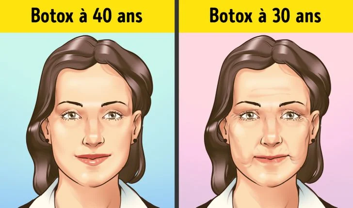 prévenir les rides