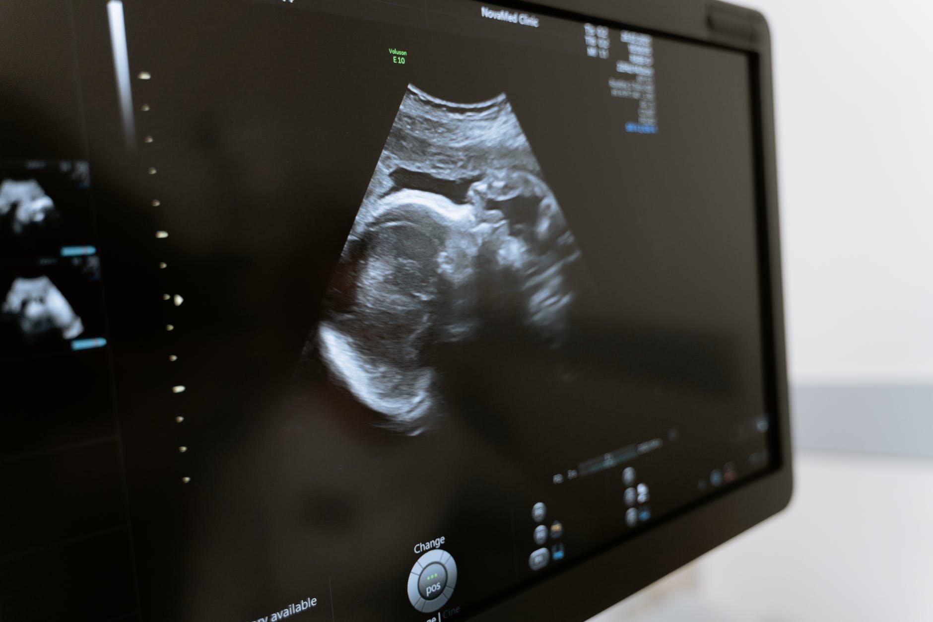 fertilité femme bébé enceinte