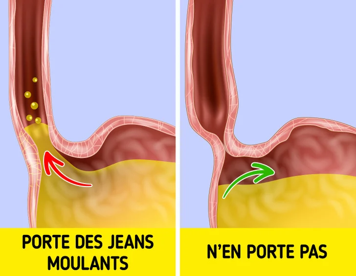 Cela peut accentuer vos brûlures d'estomac