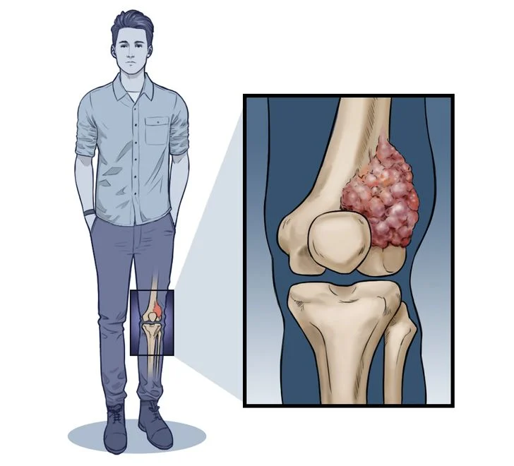 Certaines pathologies