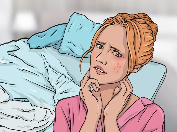 Éruptions cutanées, acné et peau irritée