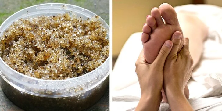 10 remèdes pour guérir et se débarrasser des pieds qui puent Gommage au sucre