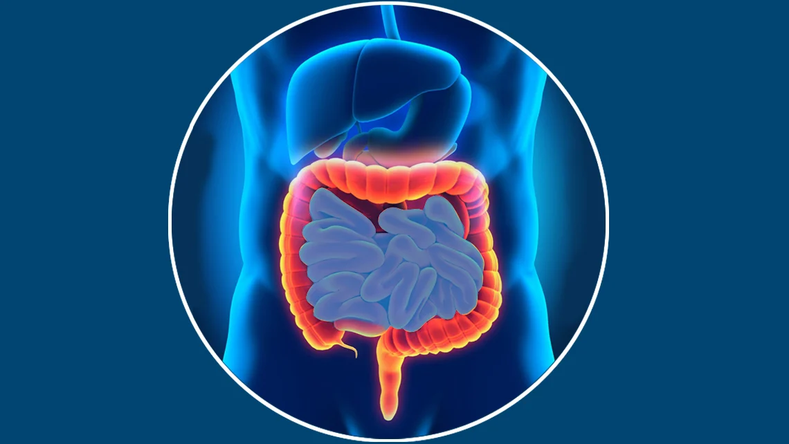 La maladie de Crohn causes