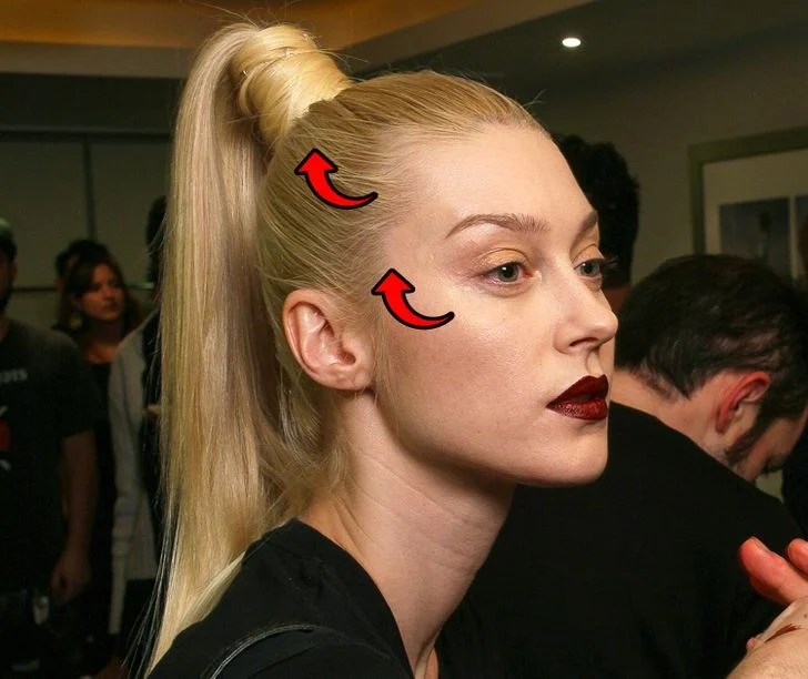 La peau de votre visage peut s'étirer