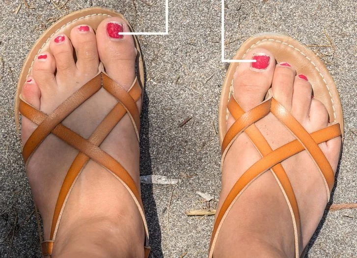 Laisser le vernis à ongles en place trop longtemps