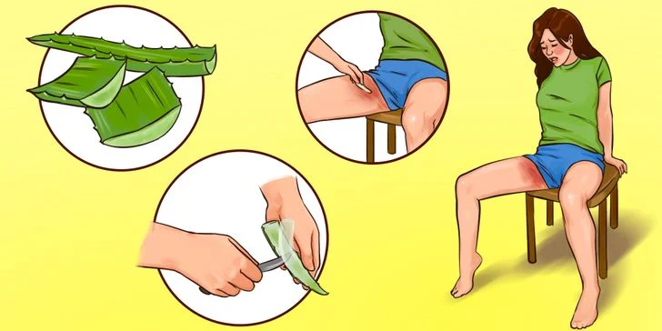 Le gel d'aloe vera