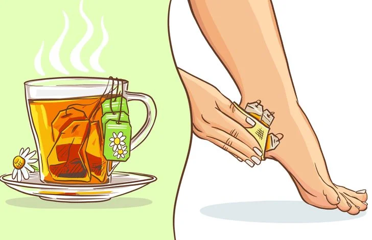 La camomille pour soulager les ampoules