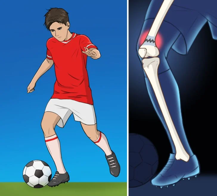 Les blessures liées au sport