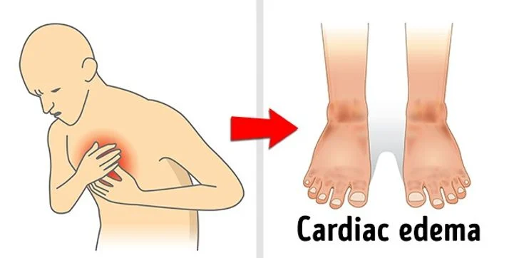 Maladies cardiaques