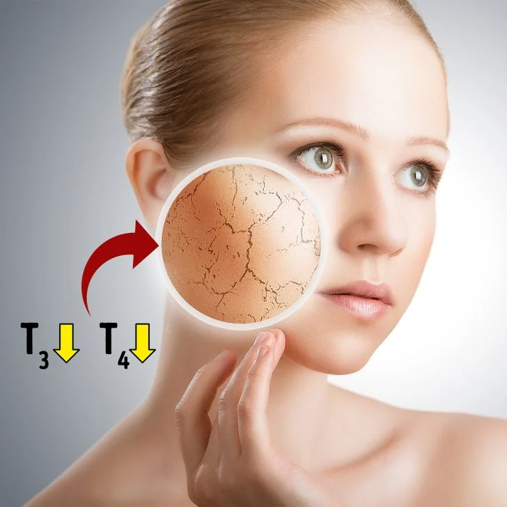 Peau sèche, rouge, amincie, irritée ou qui démange
